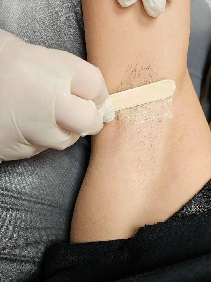 Професійна воскова депіляція Запоріжжя - результат процедури VelvetSkin №4